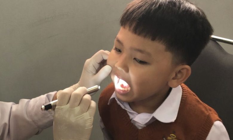 CKG Perkuat Kesehatan Berkualitas lewat Deteksi Dini Gigi Berlubang Anak